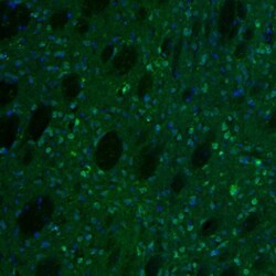 Invitrogen NAGLU Polyclonal Antibody 100 &mu;L; Unconjugated:Antibodies,