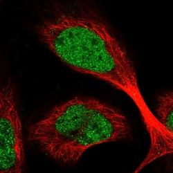 Invitrogen C1orf86 Polyclonal Antibody 100 &mu;L | Buy Online | Invitrogen&trade; | Fisher Scientific