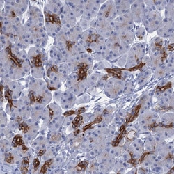 Invitrogen C1orf86 Polyclonal Antibody 100 &mu;L | Buy Online | Invitrogen&trade; | Fisher Scientific