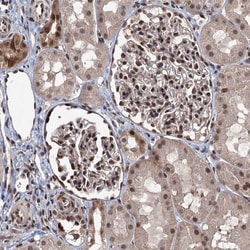 Invitrogen RASSF4 Polyclonal Antibody 100 &mu;L; Unconjugated:Antibodies,