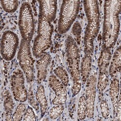 Invitrogen RASSF4 Polyclonal Antibody 100 &mu;L; Unconjugated:Antibodies,