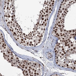 Invitrogen RASSF4 Polyclonal Antibody 100 &mu;L; Unconjugated:Antibodies,