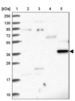Invitrogen RASSF4 Polyclonal Antibody 100 &mu;L; Unconjugated:Antibodies,