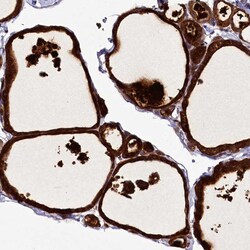 Invitrogen ZC3H12C Polyclonal Antibody 100 &mu;L; Unconjugated:Antibodies,