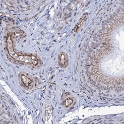 Invitrogen ZC3H12C Polyclonal Antibody 100 &mu;L; Unconjugated:Antibodies,