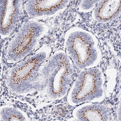 Invitrogen C11orf96 Polyclonal Antibody 100 &mu;L; Unconjugated:Antibodies,