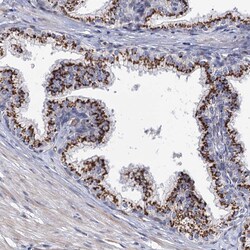 Invitrogen C11orf96 Polyclonal Antibody 100 &mu;L; Unconjugated:Antibodies,
