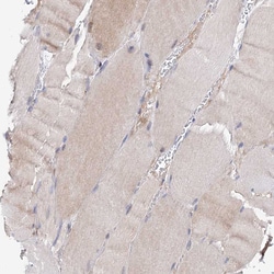 Invitrogen C11orf96 Polyclonal Antibody 100 &mu;L; Unconjugated:Antibodies,
