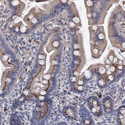 Invitrogen C11orf96 Polyclonal Antibody 100 &mu;L; Unconjugated:Antibodies,