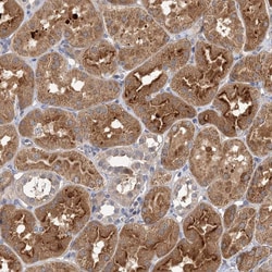 Invitrogen FBXW8 Polyclonal Antibody 100 &mu;L | Buy Online | Invitrogen&trade; | Fisher Scientific