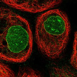 Invitrogen CCDC77 Polyclonal Antibody 100 &mu;L; Unconjugated:Antibodies,