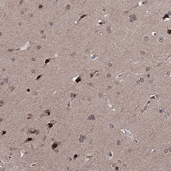 Invitrogen CCDC77 Polyclonal Antibody 100 &mu;L; Unconjugated:Antibodies,