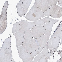 Invitrogen CCDC77 Polyclonal Antibody 100 &mu;L; Unconjugated:Antibodies,