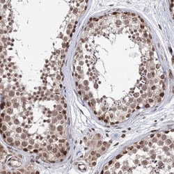 Invitrogen CCDC77 Polyclonal Antibody 100 &mu;L; Unconjugated:Antibodies,