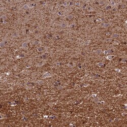 Invitrogen DENND5B Polyclonal Antibody 100 &mu;L; Unconjugated:Antibodies,