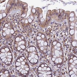 Invitrogen DENND5B Polyclonal Antibody 100 &mu;L; Unconjugated:Antibodies,