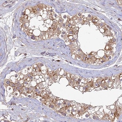 Invitrogen DENND5B Polyclonal Antibody 100 &mu;L; Unconjugated:Antibodies,