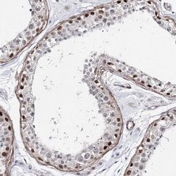 Invitrogen TTC40 Polyclonal Antibody 100 &mu;L; Unconjugated:Antibodies,
