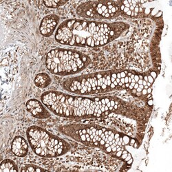 Invitrogen TTC40 Polyclonal Antibody 100 &mu;L; Unconjugated:Antibodies,