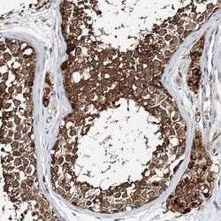 Invitrogen TTC40 Polyclonal Antibody 100 &mu;L; Unconjugated:Antibodies,