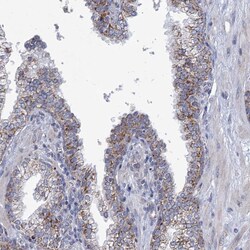Invitrogen NDUFC2 Polyclonal Antibody 100 &mu;L | Buy Online | Invitrogen&trade; | Fisher Scientific