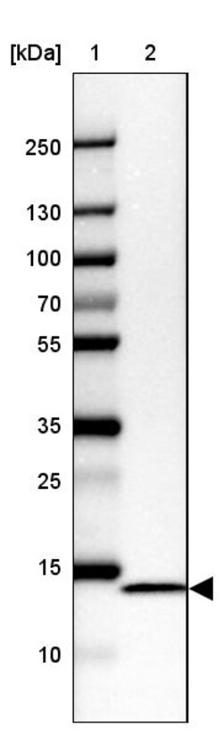 Invitrogen NDUFC2 Polyclonal Antibody 100 &mu;L | Buy Online | Invitrogen&trade; | Fisher Scientific