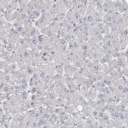 Invitrogen GTSF1 Polyclonal Antibody 100 &mu;L | Buy Online | Invitrogen&trade; | Fisher Scientific
