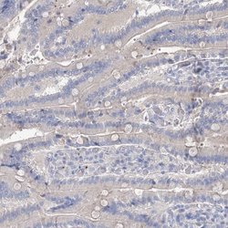 Invitrogen MYL6B Polyclonal Antibody 100 &mu;L; Unconjugated:Antibodies,
