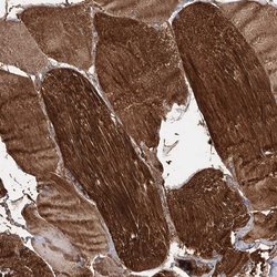 Invitrogen MYL6B Polyclonal Antibody 100 &mu;L; Unconjugated:Antibodies,