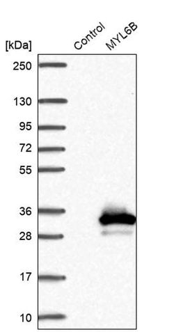 Invitrogen MYL6B Polyclonal Antibody 100 &mu;L; Unconjugated:Antibodies,