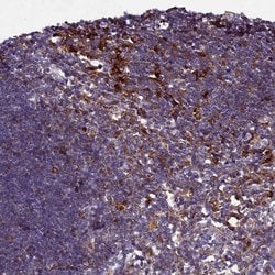 Invitrogen HDC Polyclonal Antibody 100 &mu;L; Unconjugated:Antibodies,