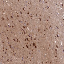 Invitrogen HDC Polyclonal Antibody 100 &mu;L; Unconjugated:Antibodies,