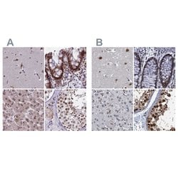 Invitrogen PPHLN1 Polyclonal Antibody 100 &mu;L; Unconjugated:Antibodies,