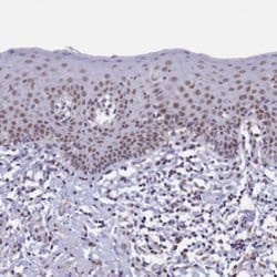 Invitrogen PPHLN1 Polyclonal Antibody 100 &mu;L; Unconjugated:Antibodies,