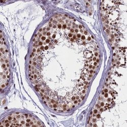 Invitrogen PPHLN1 Polyclonal Antibody 100 &mu;L; Unconjugated:Antibodies,