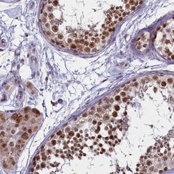 Invitrogen PPHLN1 Polyclonal Antibody 100 &mu;L; Unconjugated:Antibodies,