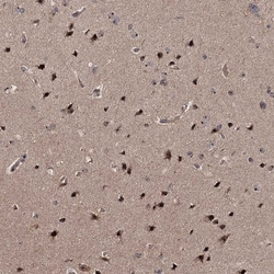 Invitrogen FAM48A Polyclonal Antibody 100 &mu;L; Unconjugated:Antibodies,