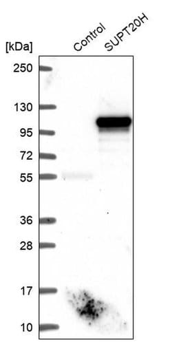 Invitrogen FAM48A Polyclonal Antibody 100 &mu;L; Unconjugated:Antibodies,