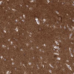 Invitrogen PACS1 Polyclonal Antibody 100 &mu;L; Unconjugated:Antibodies,