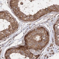 Invitrogen PACS1 Polyclonal Antibody 100 &mu;L; Unconjugated:Antibodies,