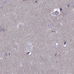 Invitrogen ODF3 Polyclonal Antibody 100 &mu;L; Unconjugated:Antikörper