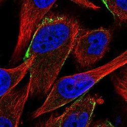 Invitrogen CFHR1 Polyclonal Antibody 100 &mu;L; Unconjugated:Antibodies,