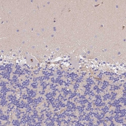 Invitrogen CFHR1 Polyclonal Antibody 100 &mu;L; Unconjugated:Antibodies,