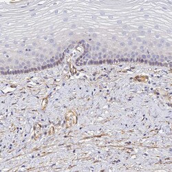 Invitrogen CFHR1 Polyclonal Antibody 100 &mu;L; Unconjugated:Antibodies,