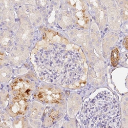 Invitrogen CFHR1 Polyclonal Antibody 100 &mu;L; Unconjugated:Antibodies,