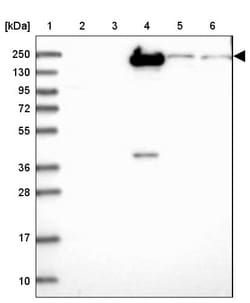 Invitrogen CFHR1 Polyclonal Antibody 100 &mu;L; Unconjugated:Antibodies,