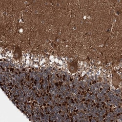 Invitrogen C11orf80 Polyclonal Antibody 100 &mu;L; Unconjugated:Antibodies,