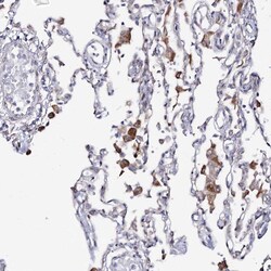 Invitrogen C11orf80 Polyclonal Antibody 100 &mu;L; Unconjugated:Antibodies,