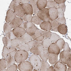 Invitrogen C11orf80 Polyclonal Antibody 100 &mu;L; Unconjugated:Antibodies,