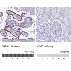 hCG beta Polyclonal Antibody, Invitrogen 100 &mu;L; Unconjugated:Antibodies,